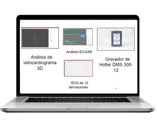 Equipos Cardiología