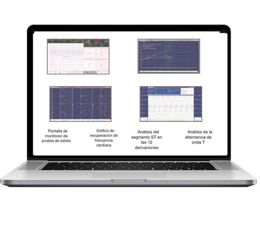 Equipos Cardiología